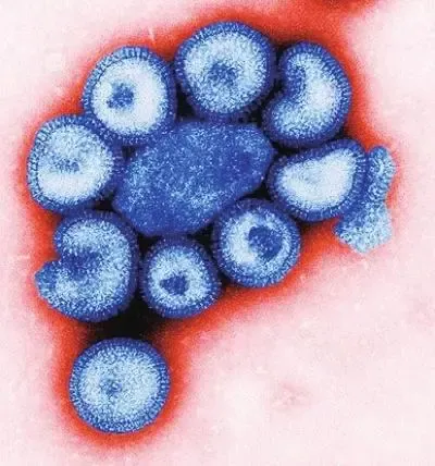 如何正确评估圆环支原体疫苗？两个层面，最重要的是看总体经济效益！