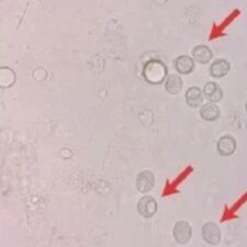 仔猪腹泻死亡率高？这份「病因 - 症状 - 处理」手册，帮你守住成活率！（三）