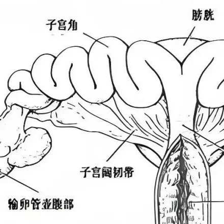 母猪产后冲洗子宫，不仅无效，反而有害